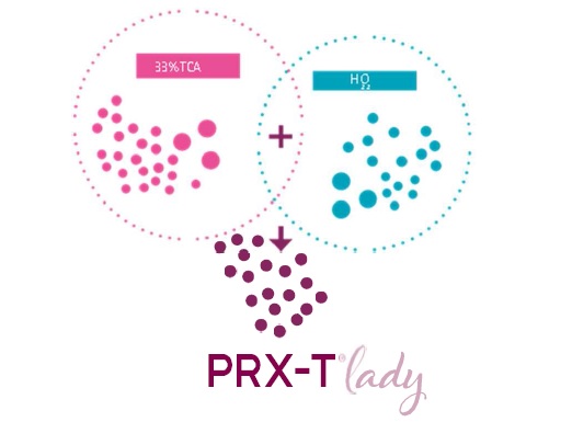 prx lady - schemat